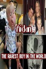 Watch Aidan The Rarest Boy In The World Primewire