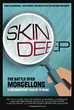 Watch Skin Deep: The Battle Over Morgellons Primewire