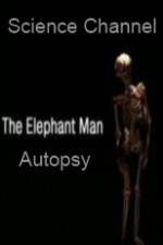 Watch Science Channel Elephant Man Autopsy Primewire