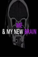 Watch Me & My New Brain Primewire
