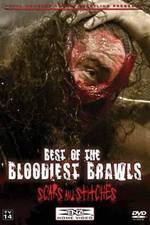Watch TNA Wrestling: Best of the Bloodiest Brawls - Scars and Stitches Primewire