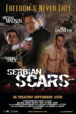 Watch Serbian Scars Primewire