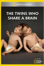 Watch National Geographic The Twins Who Share A Brain Primewire